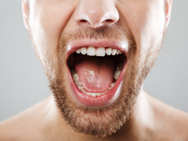 Zungenreinigung - Zungenbelag entfernen
